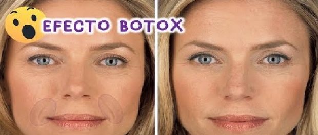 botox natural para la cara