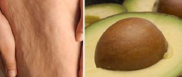 aguacate para la celulitis